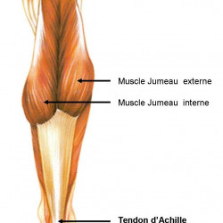 Archilles tendinitis 