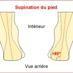 Fuß supination