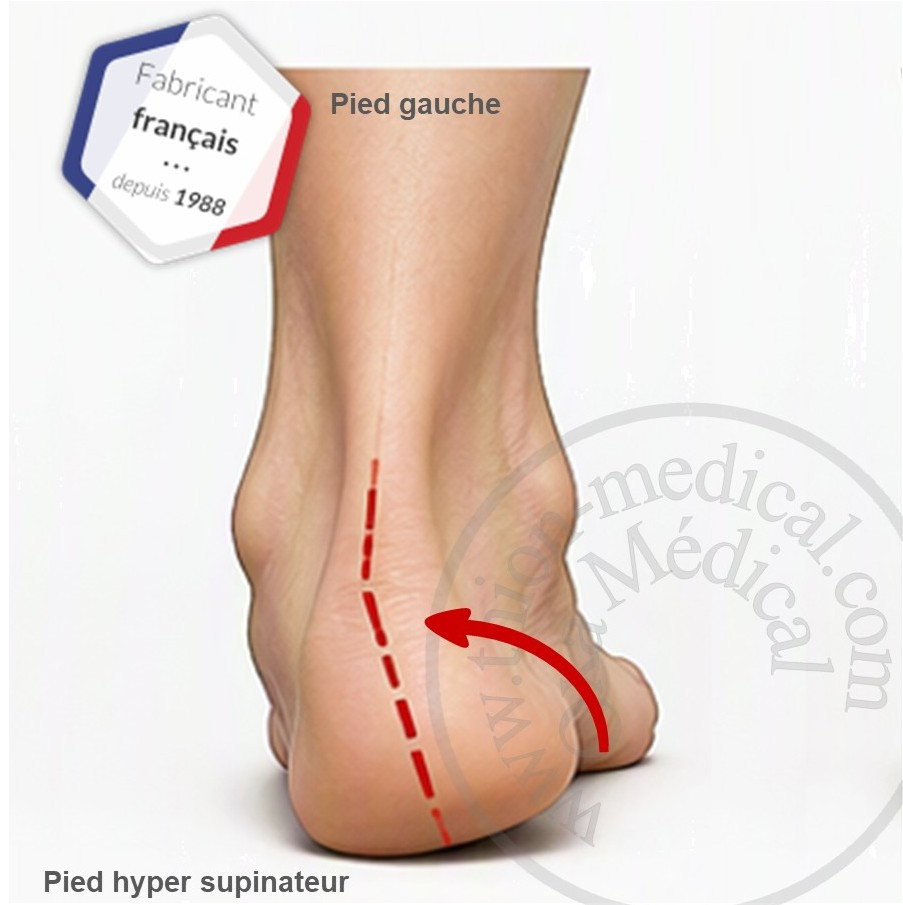 La supination du pied : Comprendre, prévenir et corriger ce déséquilibre biomécanique
