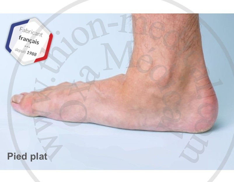 Pieds plats de l’adulte : comprendre les symptômes, les conséquences et les solutions efficaces